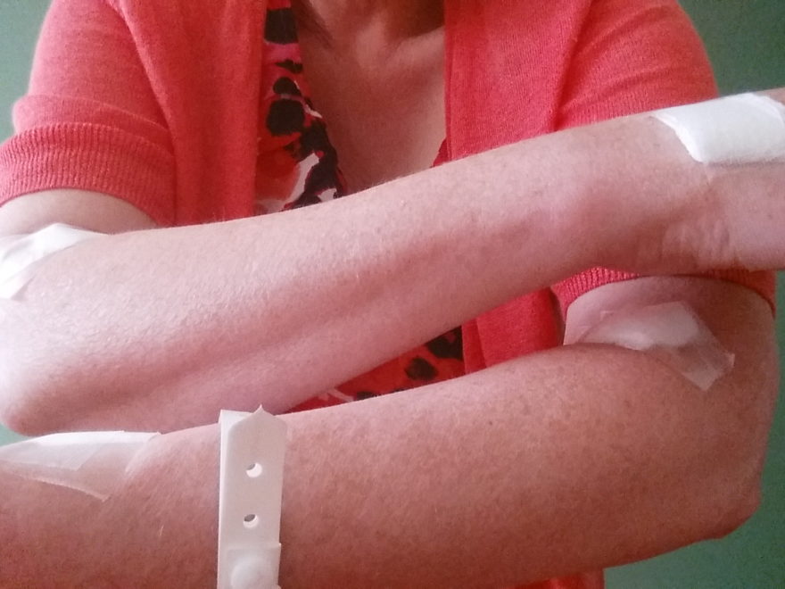 a woman wearing a hospital bracelet, with 4 bandages from injections and IV