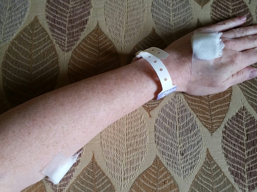 a woman's hand bearing a hospital bracelet and several bandages from IVs during day-surgery