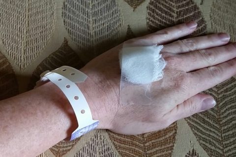 a woman's wrist with a hospital's patient identification bracelet