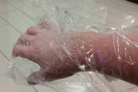 a woman's hand covered in paraffin wax