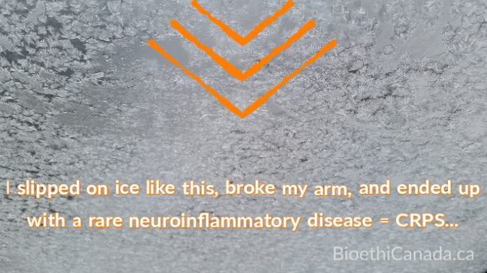 Any icy surface, with the words "I slipped on ice like this, broke my arm, and ended up with a rare neuroinflammatory disease = CRPS"