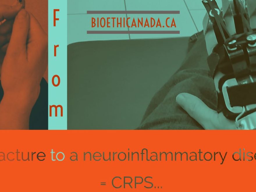 a poster of a broken arm, stating "From a fracture to neuroinflammatory disease = CRPS"