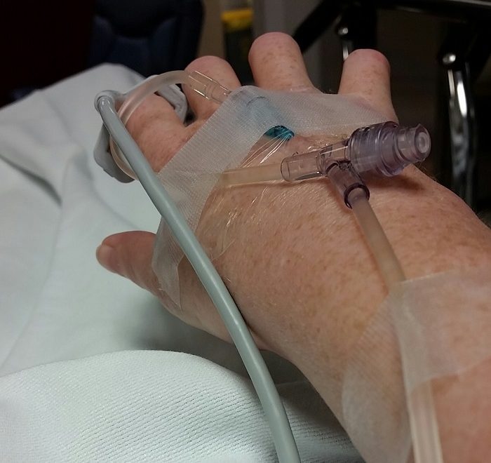 a woman's hand on a hospital bed, hooked up to monitors and and medication port