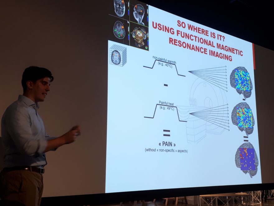 a presentation slide showing images of brain scans